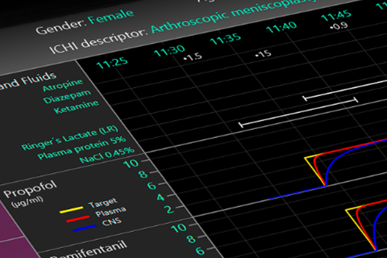 GUI interface